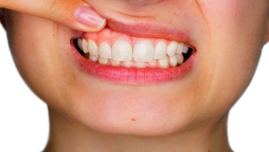 Katı Kişi Sendromu, kadınlarda iki kat fazla görülüyor