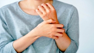 Sedef Hastalığı İlaçla Tedavi Edilebiliyor