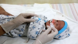 Deü Hastanesi Dudak-Damak Yarığı Tedavisinde Umut Oldu